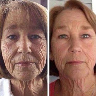 Cheek Building Exercises And Face Rubbing Solutions