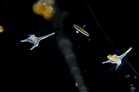 Ceratium | The Microscopic Life of Shetland Lochs