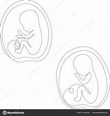 Sketch Of A Baby In The Womb Coloring Pages sketch template