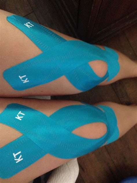 KT tape for Patellar tracking | Kinesiology taping, Kinesiology, Kt tape