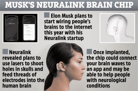 Neuralink: Elon Musk Ready To Connect Human Brain to Computer
