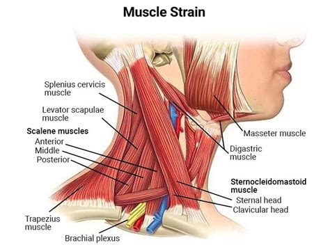 What Neck Pain on the Left Side Means - NJ's Top Orthopedic Spine & Pain Management Center