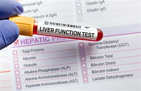 Everything You Should Know About Liver Function Tests - Prestige ER