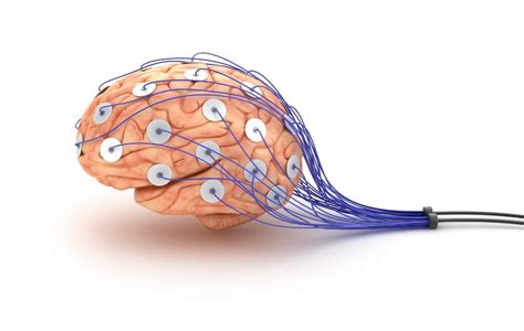 brain electroencephalogram eeg_