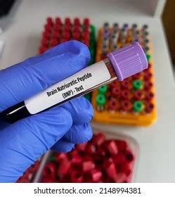 Blood Sample Bnpbrain Natriuretic Peptide Test Stock Photo 2148994381 ...