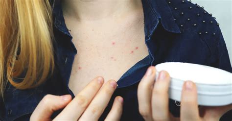 Chest Acne: Causes and Treatments, And How it Differs From Facial Acne