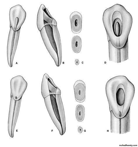 Endodontics pptx - Dr.Raghad - Muhadharaty