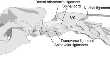 Diagnosis and Treatment of Atlantoaxial Subluxation | Veterian Key