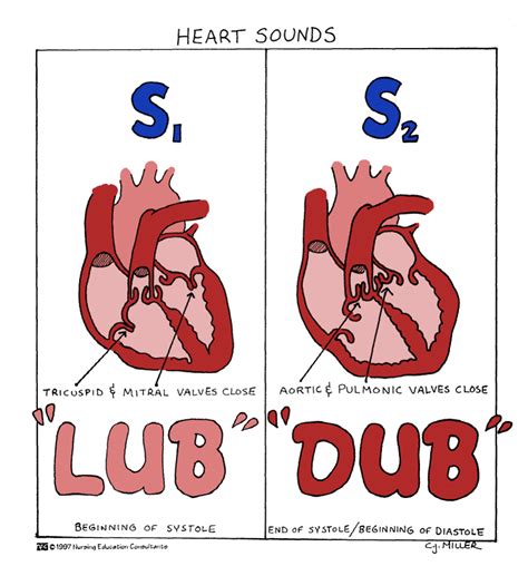 Heart Sounds | Nursing mnemonics, Heart sounds, Medical surgical nursing