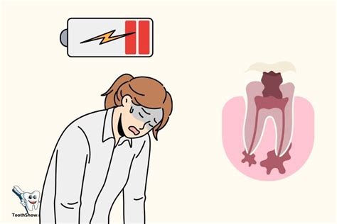 Can A Tooth Abscess Make You Tired? Yes!