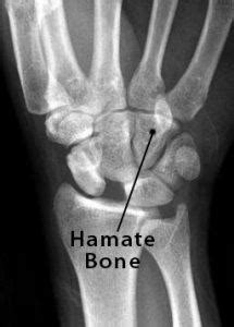 Hamate Bone Definition, Location, Anatomy, Function, & Diagram