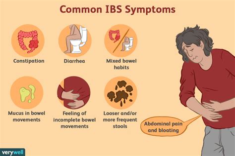 Marler Clark updates About Irritable bowel syndrome (IBS) - what you ...