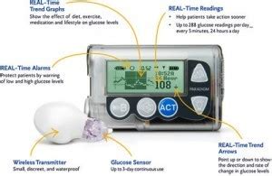 Minimed Paradigm 722 Insulin Pump - Diabetic Live