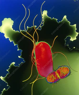 Proteus bacteria - Stock Image - B220/1164 - Science Photo Library