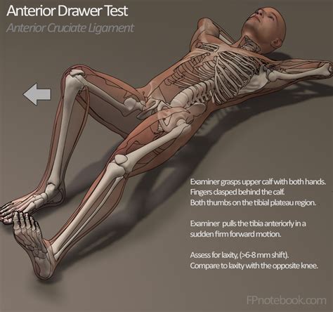 Positive Anterior Drawer Sign