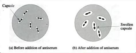 Quellung reaction: Principle, Procedure, Results • Microbe Online