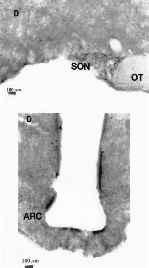 Light micrographs showing the supraoptic nucleus (SON; top) and the... | Download Scientific Diagram