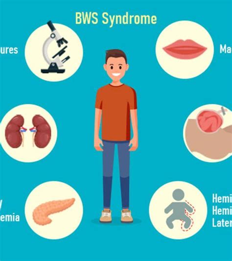 Beckwith-Wiedemann Syndrome: Symptoms, Causes And Treatment