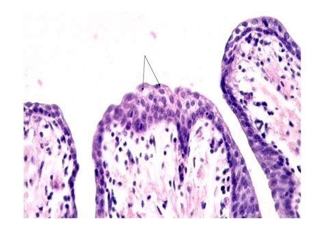 Epithelium ii