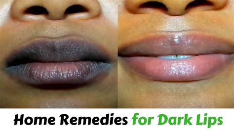 How To Get Rid Of Black Lips how to get rid of black lips | home ...