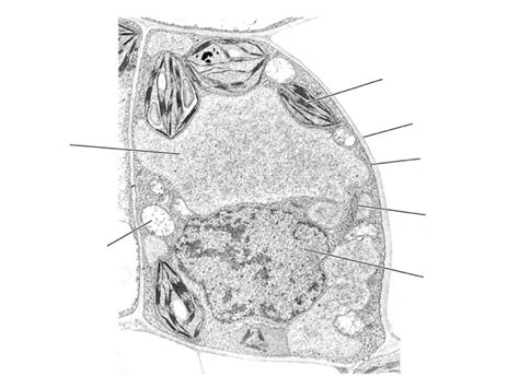 Mitochondria Electron Micrograph Labelled