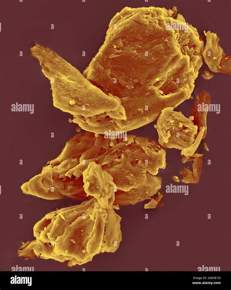 Coloured scanning electron micrograph (SEM) of Xanthan gum, polysaccharide produced by the ...