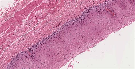 Pharynx, Esophagus, and Stomach | histology