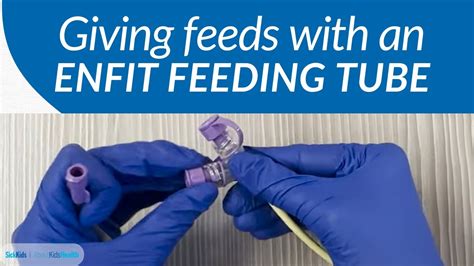 How to give feeds with an ENFit feeding tube | AboutKidsHealth at The Hospital for Sick Children ...