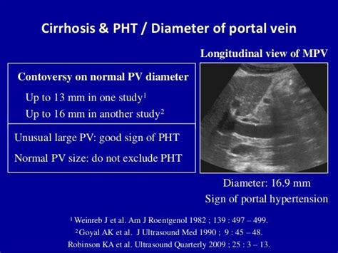 Doppler ultrasound of the portal system - Pathological findings