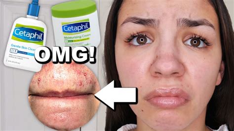 I Used Cetaphil Skincare For One Week! - YouTube
