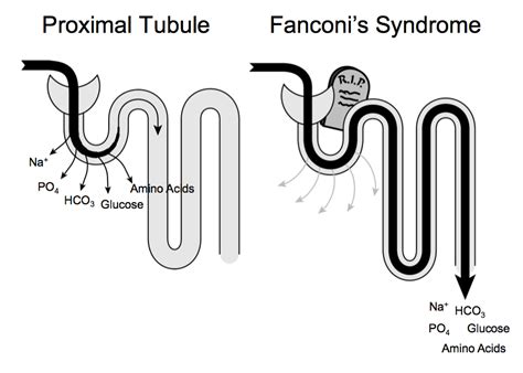 glomerular and tubular dysfunction‏ - بحث Google‏ | Renal physiology, Renal, Physiology