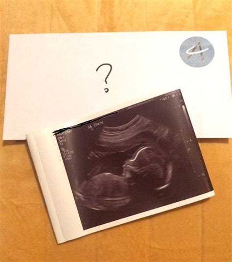 20 week anatomy scan. Gender in an envelope ready for gender reveal at the weekend! 😍 what do ...