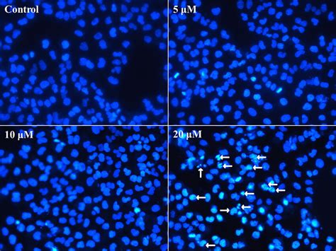 The nuclear chromatin condensation and the formation of apoptotic... | Download Scientific Diagram