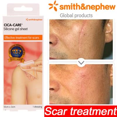 Qoo10 - [SMITH NEPHEW] Cica-Care Silicone Gel Sheeting / Burn scar ...