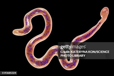 Brugia Malayi Parasitic Worm Illustration High-Res Vector Graphic ...