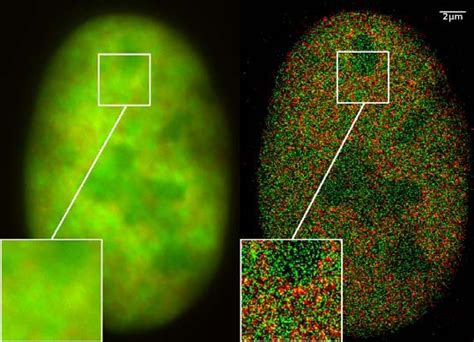 Super-resolution microscopy - Wikipedia