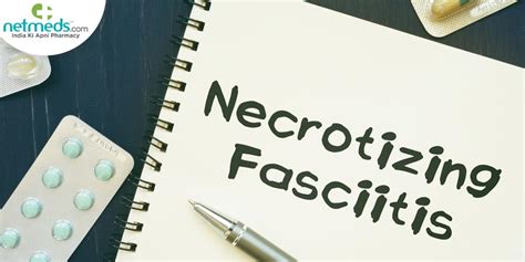 Necrotizing Fasciitis: Symptoms, Causes And Treatment