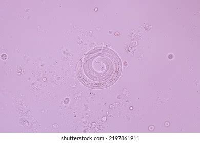 View Microscopic Strongyloides Stercoralis Threadworm Human库存照片2197861911 | Shutterstock