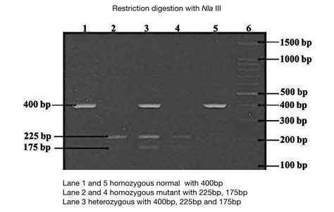 Part 2: Analysing and Interpreting (Agarose) Gel Electrophoresis Results