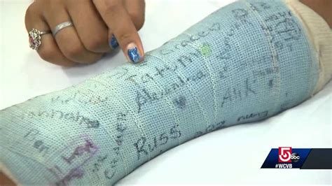 Cast-removal procedure reducing injuries