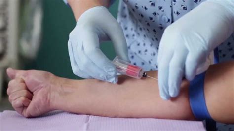 Venipuncture Flops and Complications - YouTube