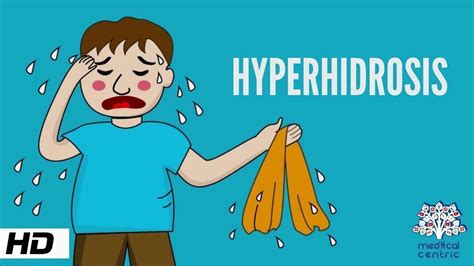 Hyperhidrosis, Causes, Signs and Symptoms, Diagnosis and Treatment. - YouTube