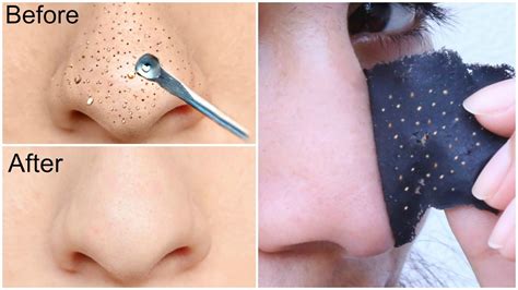 Easy Blackhead Remover Peel Off Mask - Instant Results - Ethnic Fashion Inspirations!