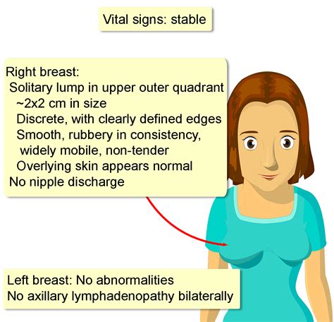 The Causes Of Multicameral World Breast Cancer Vector Illustration On ...