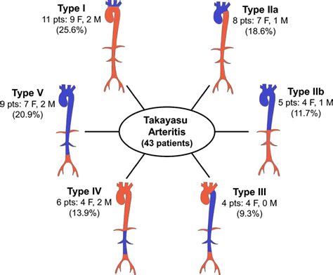 Takayasu Arteritis Classification