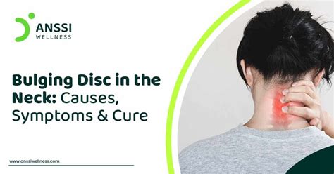 Bulging Disc in the Neck: Causes, Symptoms & Cure