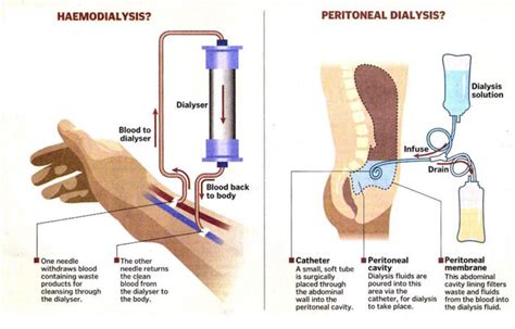 Services — Southwest Renal Care