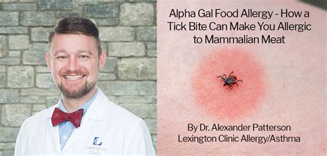 Alpha Gal Food Allergy - How a Tick Bite Can Make You Allergic to ...