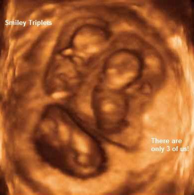 3d Ultrasound Pregnancy :: 3d Puzzle Image