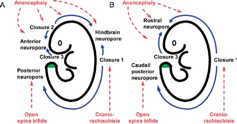 Figure 1 from Genetics and development of neural tube defects. | Semantic Scholar